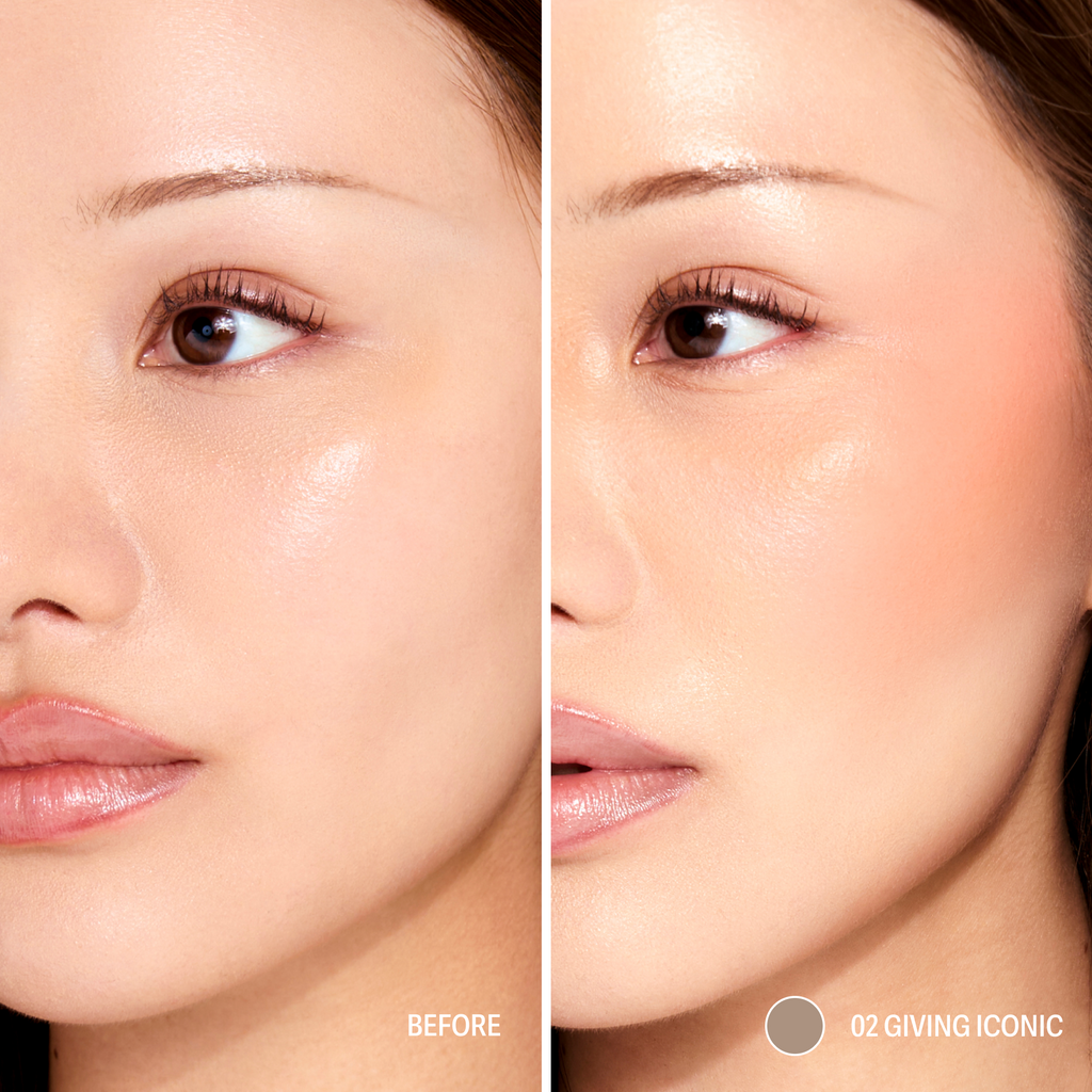 Contour STAY-N®